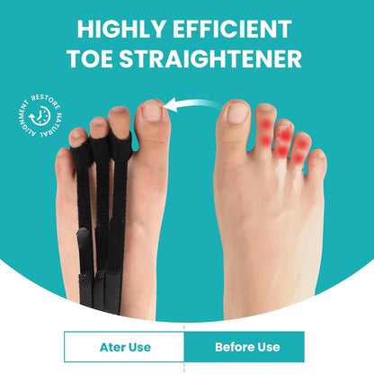 Promifun Hammer Toe Straightener Corrector