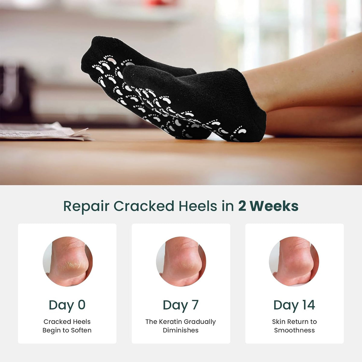 Promifun Silicone Moisturizing Socks for Women & Men Dry Cracked Heel Socks Feet Repair Heel,2 Pairs,Size W6-9/M5-8,Black